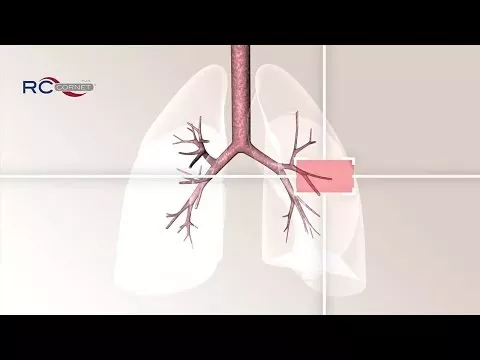 Video su RC Cornetta Plus, 1 pz