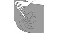 CLOTRIMAZOL AL 200 compresse vaginali, 3 pezzi