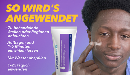 BENZAKNEN Sospensione di lavaggio 5%, 2X100 g