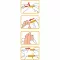 WELLION Safetylancets 28 G smalti di sicurezza, 25 pz