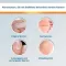 Soluzione EndWarts® CLASSIC , 3 ml